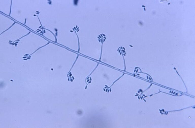 Sporothrix schenckii Nədir?