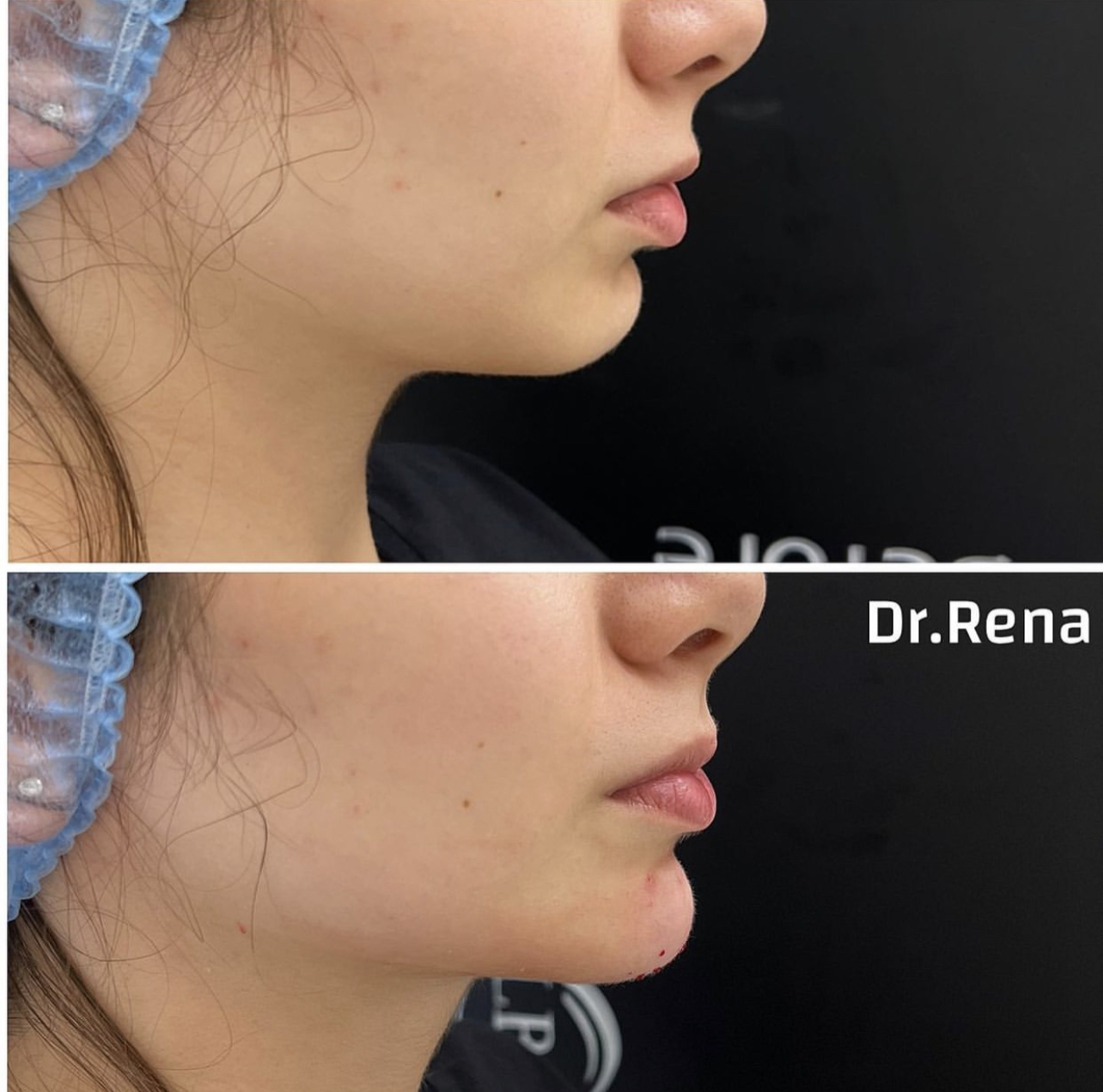 Jawline Image 1