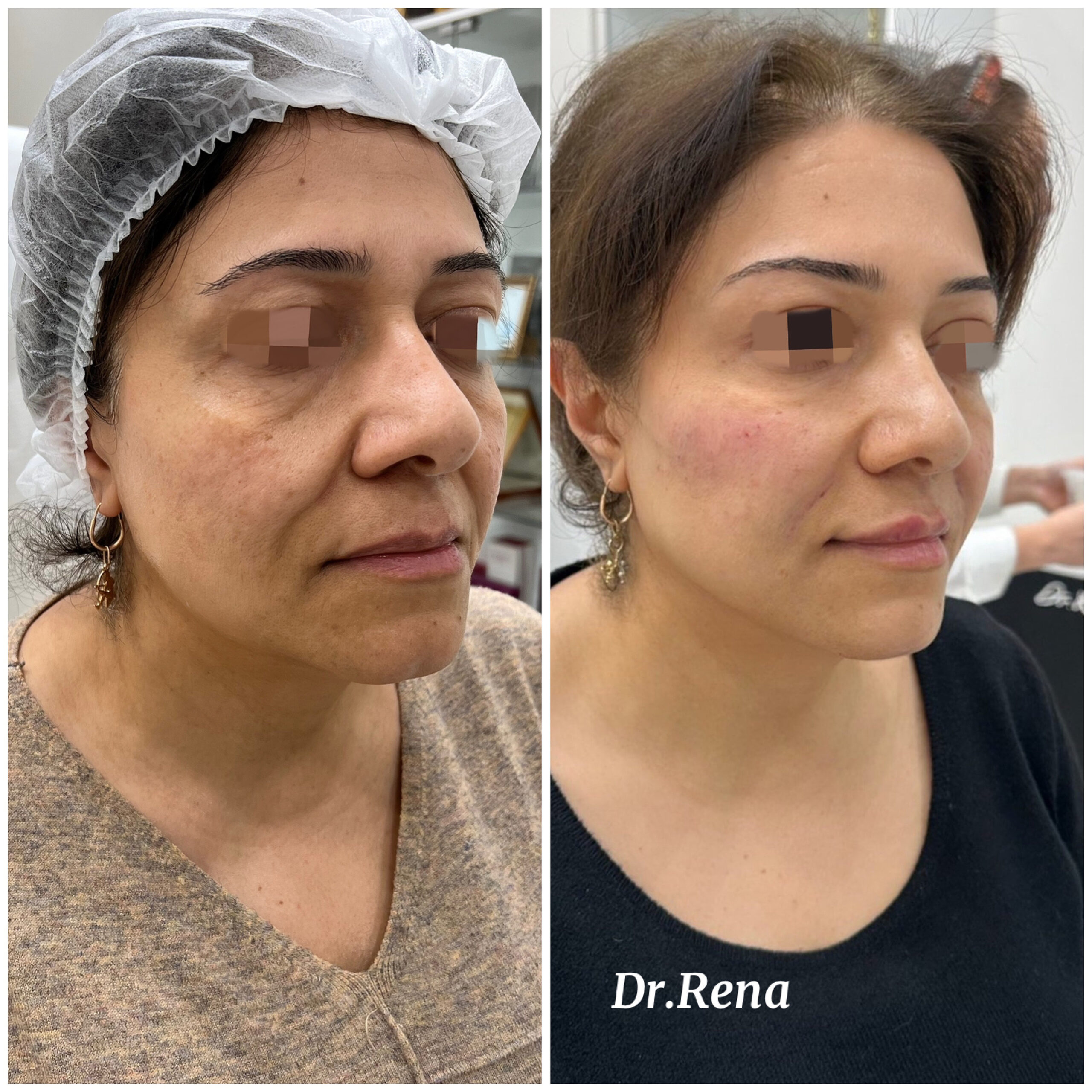Fullface Image 1