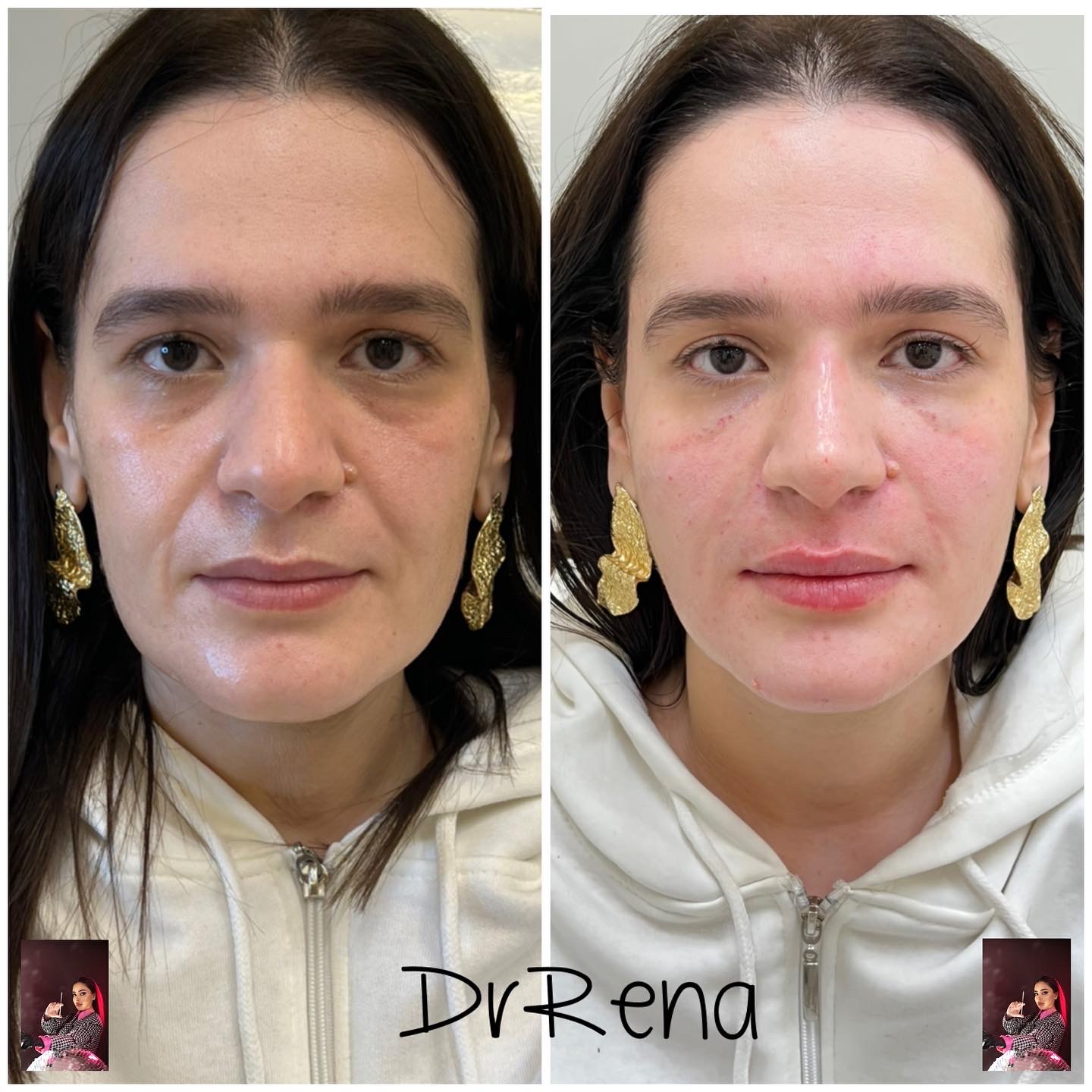 Fullface Image 2