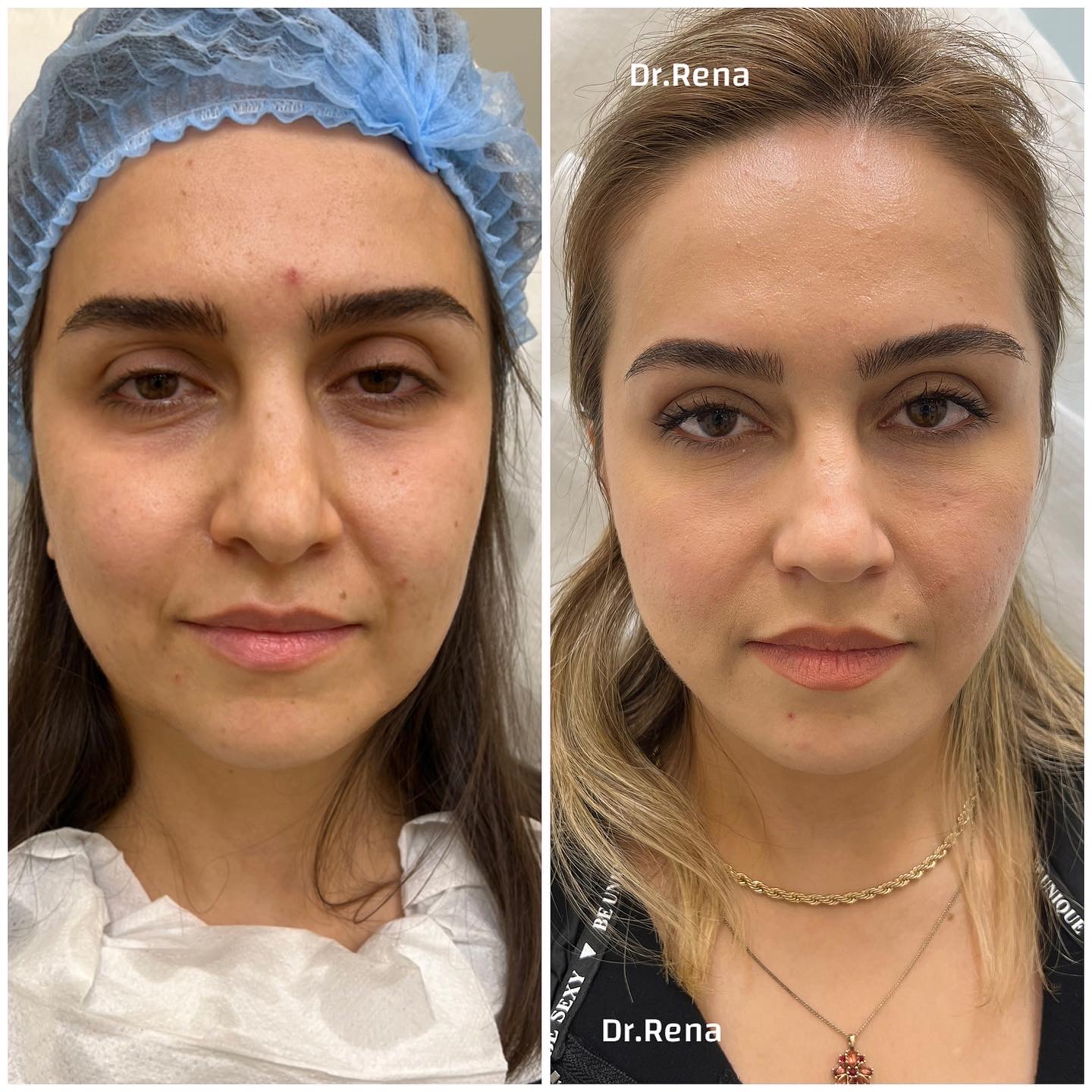 Fullface Image 4